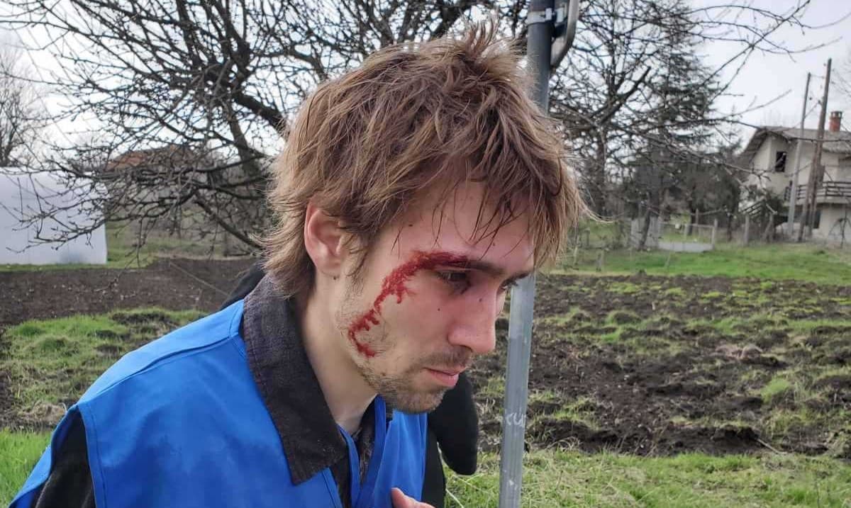 Journalistic Section of the SRG: The assault on journalists and citizens continues, and the behavior of the police is unacceptable.