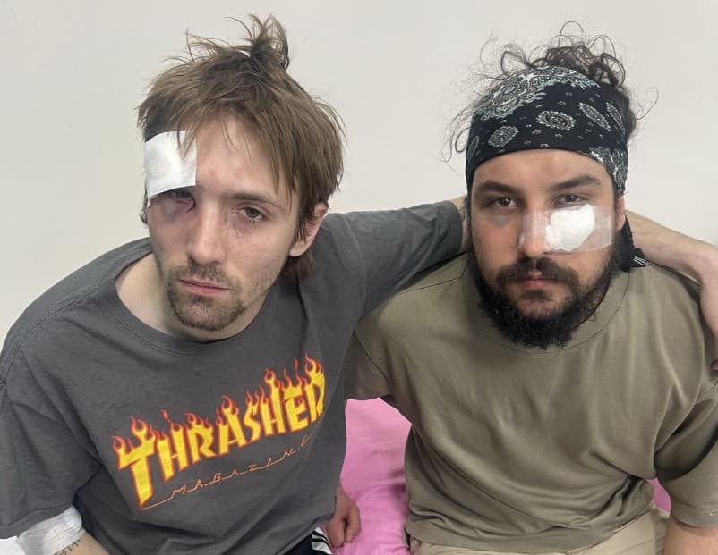 ANEM ALARM: After the beating of editors and journalists, the magazine Revolt is under death threats.