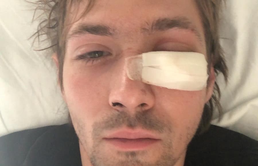 ANEM ALARM: Novinar Revolta Lazar Dinić, koji je teško povređen 29. marta, uspešno operisan i oporavlja se